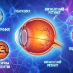 До яких захворювань схильна сітківка ока?