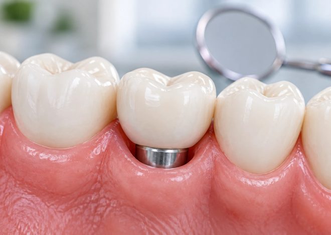 Dental implant healing abutment visible between two natural teeth in the gum, with a mirror in the background.